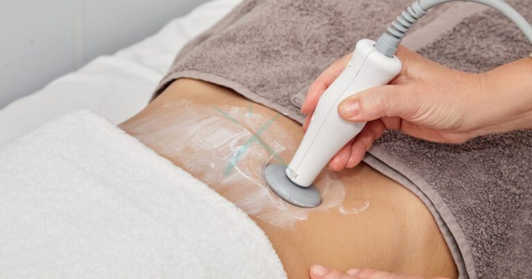 Lipo Without Surgery Exploring Non Invasive Alternatives