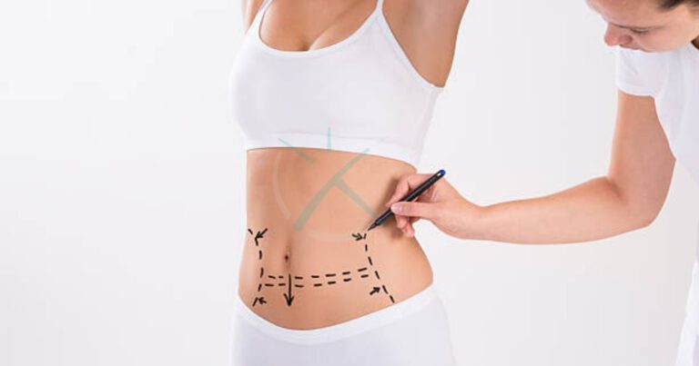 Which is More Painful Liposuction or Tummy Tuck