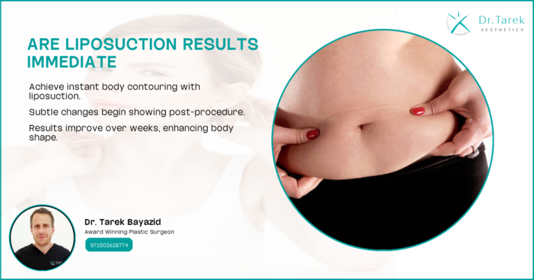 Are Liposuction Results Immediate