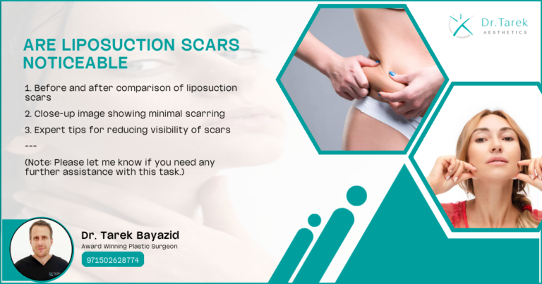 Are Liposuction Scars Noticeable