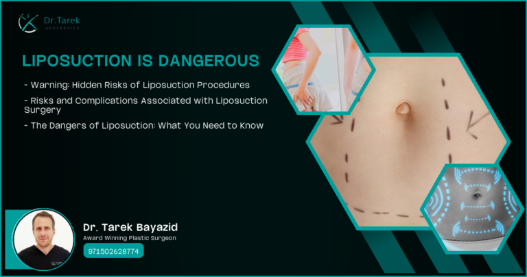 Liposuction Is Dangerous